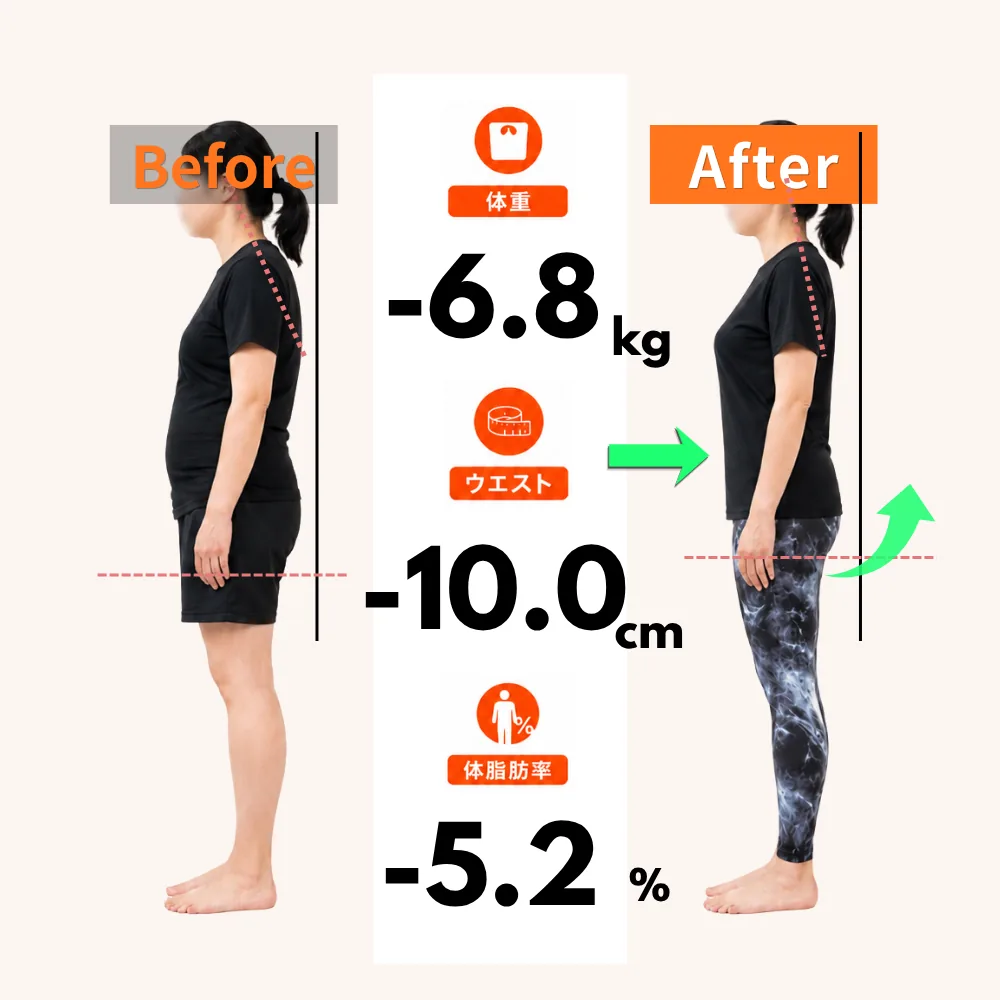 30代女性のお客様のビフォーアフター（モデル）